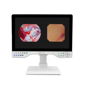 Medical 24" FHD Laparoscopic Imaging System 80Watts LED Cold Light Source &