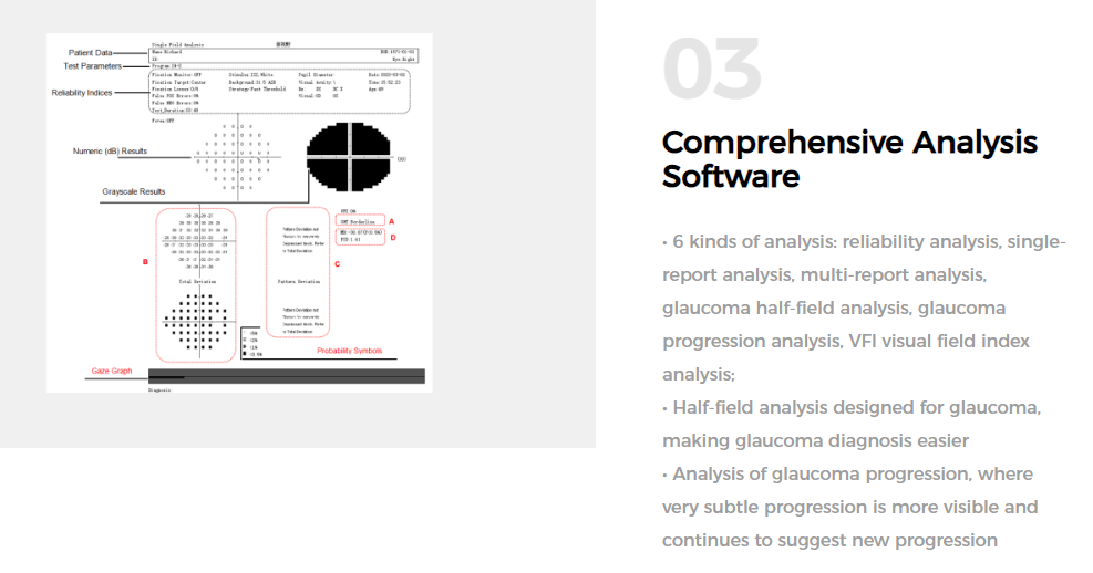 Hospital Automated Perimetry Machine Goldmann III 240V 50Hz