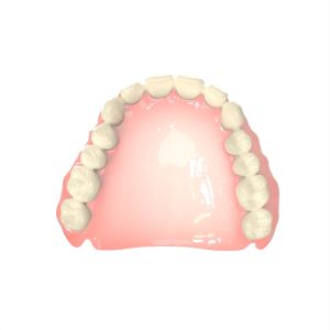 Denture Fabrication Light Cured Resin Lightweight Biocompatible Resin