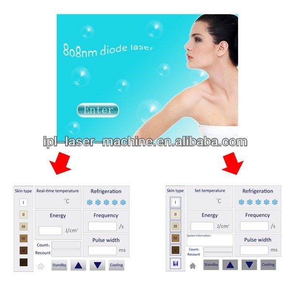 70J/cm2 output power 808 Nm Diode Laser unwanted Hair Removal Machine for salon