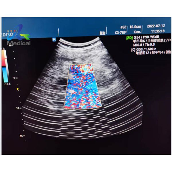 Quality Medison X6 Ultrasonic Board Repair Solutions Image Interference for sale