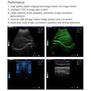250mm Depth LED Display Medical Ultrasound Scanner