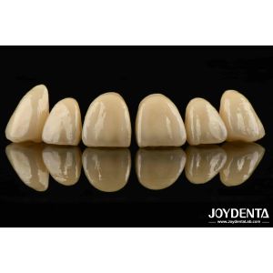 Bionic Development Leaves And Distinct Layers Of Zirconia All-Ceramic