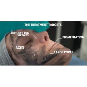 Multifunctional Q Switch ND Yag Laser Machine For Tattoo Removal / Pigmentation