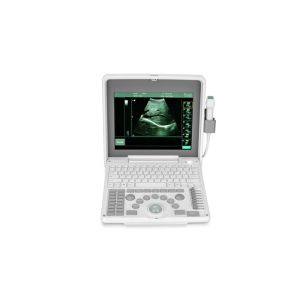 12 Inch Notebook Portable Ultrasound Scanner With Window 10 system(PC)