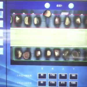 Labor Saving AI Powered Chestnut Sorting Machine: Smart Assistance, Cost