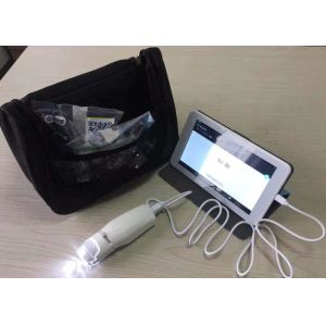 Monitor Treatment and Prevent Recurrence Digital Electronic Colposcope Self -