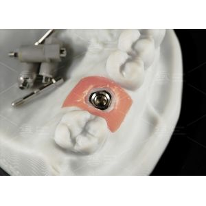 Precision Titanium Digital Implant Scan Body Sandblasted Surface For Cad/Cam