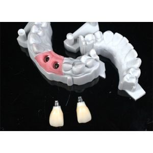 Natural-looking Zirconia Dental Crown with Excellent Biocompatibility and