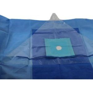 SMS SSMMS Knee Arthroscopy Surgical Pack Ethylene Oxide Sterile