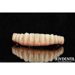 Custom-made Ti-Bar Zirconia Hybrid Bridge For Comfort And Durability In Dental