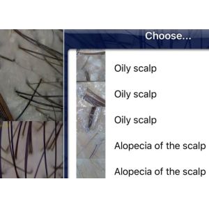 Handhled Digital Skin Moisture And Oil Analyzer With Professional Software