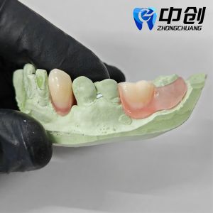 Customization Meets Comfort Invisible Denture Transparent Resin With Ergonomic