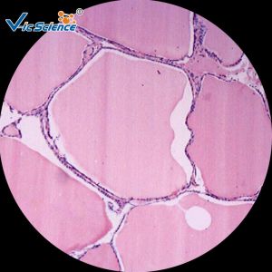 Laboratory Pathology Microscope Slides / Human Pathology Slides Set 100 Pieces