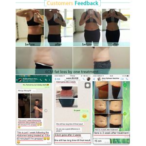 Newest 4 Hands Fat Freeze Etg 50-3s Strong Competitive Price Cryolipolysis