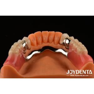 Framework Setup Teeth Finish Elaborate Technology Beautiful Harmonious