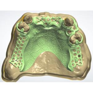 High Strength Casting Metal Partial Denture Cocr Aolly With 3D Printing