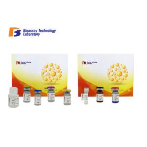 Wholesale Phosphofructokinase Muscle Human ELISA Kit 0.096ng/Ml With 2 Hours Assay Time from china suppliers