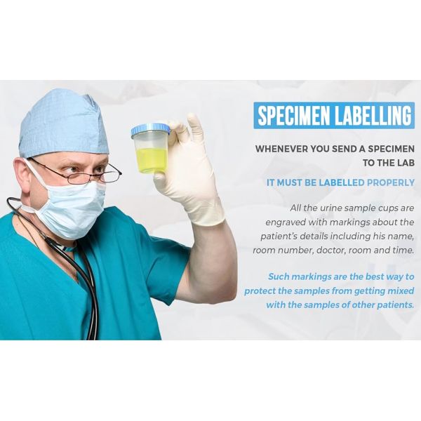 specimen labelling support cups